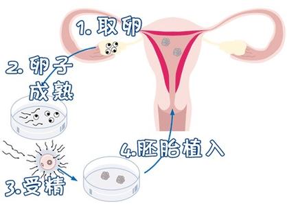 关于供卵代生医院代生包成功